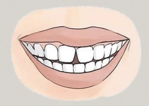 <a href=http://www.jjspa.com.cn/news_article?news_id=116>一次性口腔探針</a>